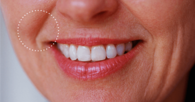 Bigode chinês como prevenir e suavizar